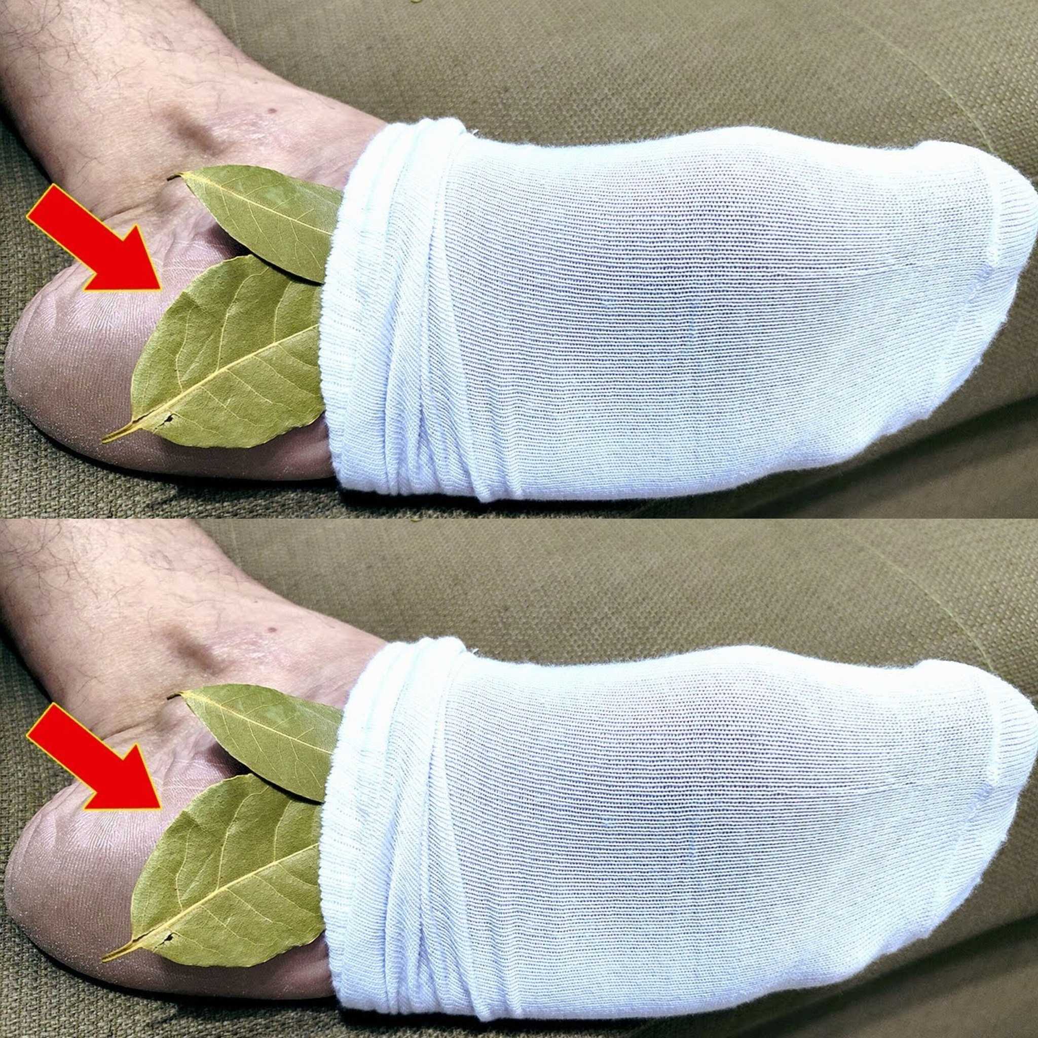 The Surprising Benefits of Placing a Bay Leaf on Your Feet