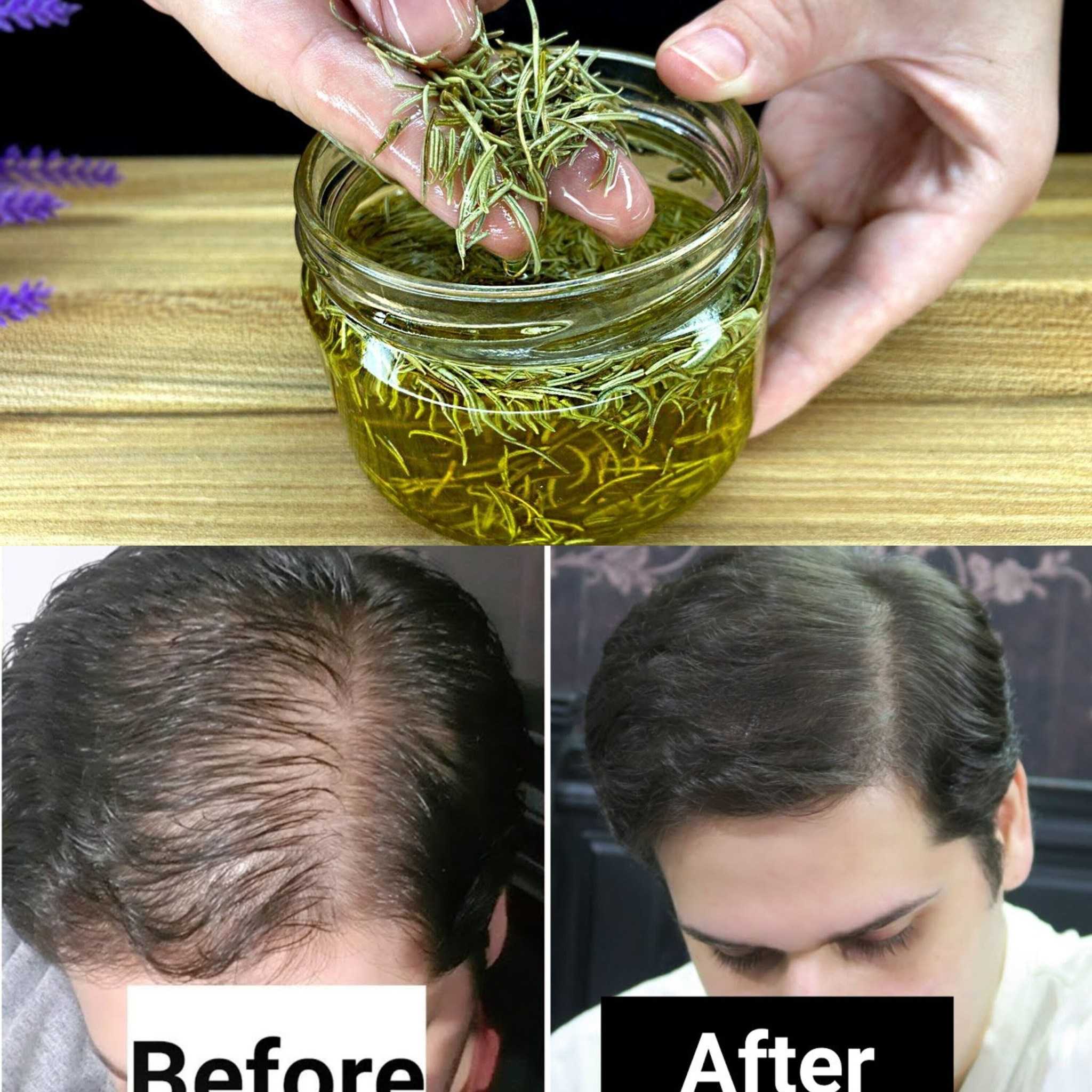 Hair Grows Extremely Quickly: The Best Rosemary Recipes for Hair Growth!