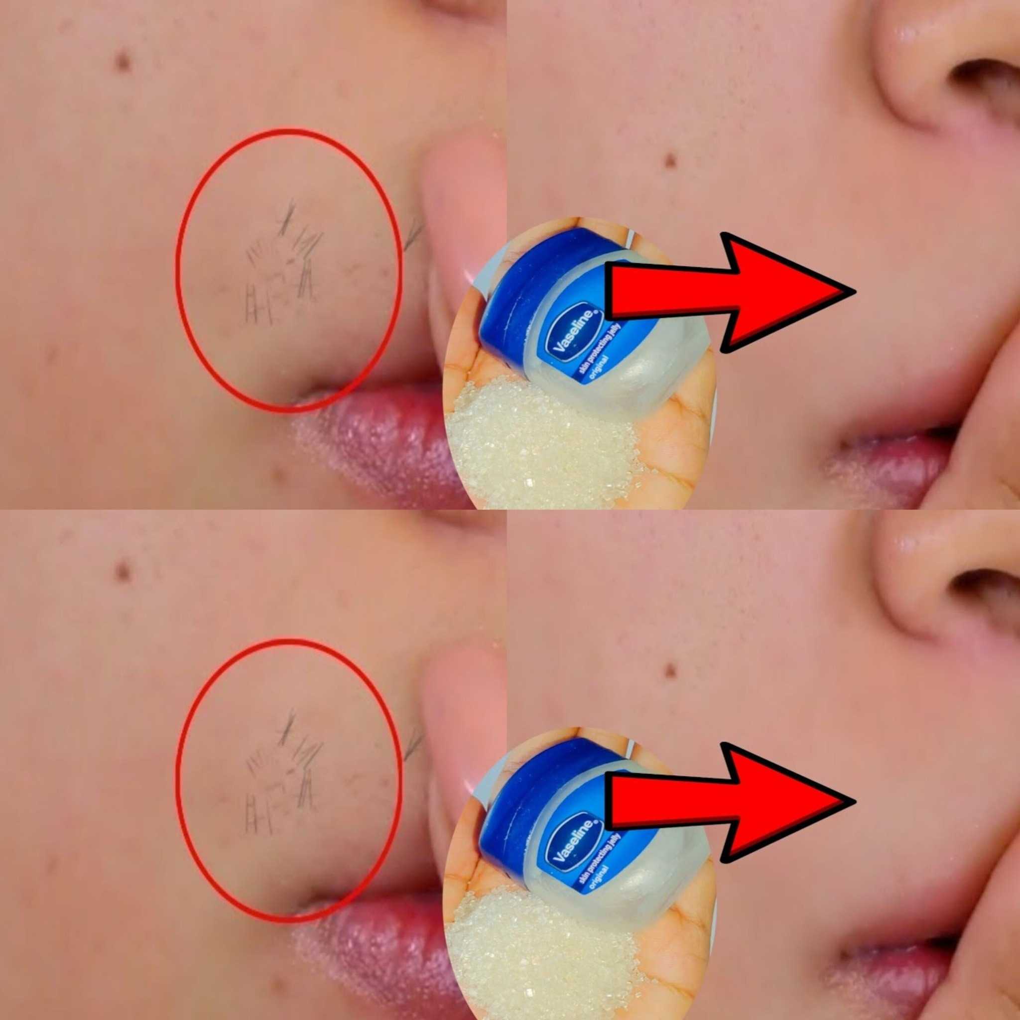 Vaseline for Upper Lip Hair Removal | Vaseline to Remove Facial Hair Permanently