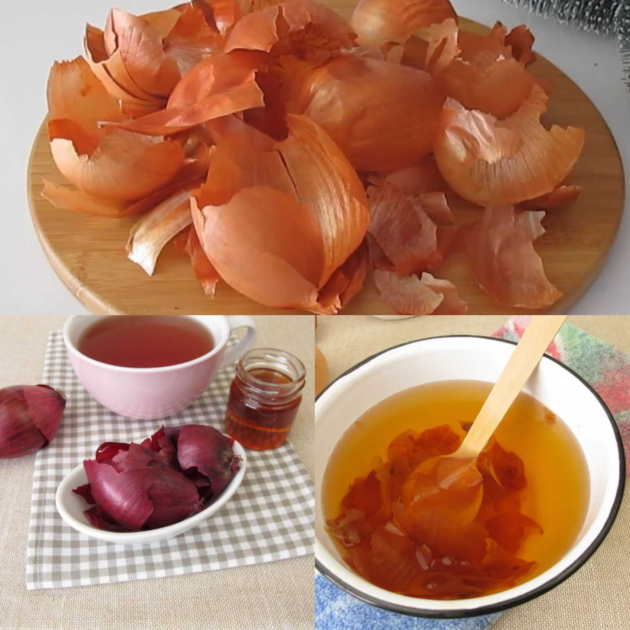 Bladder and Prostate Will Be Like New! Grandpa’s Old Recipe Using Onion Peels – Healthy and Easy