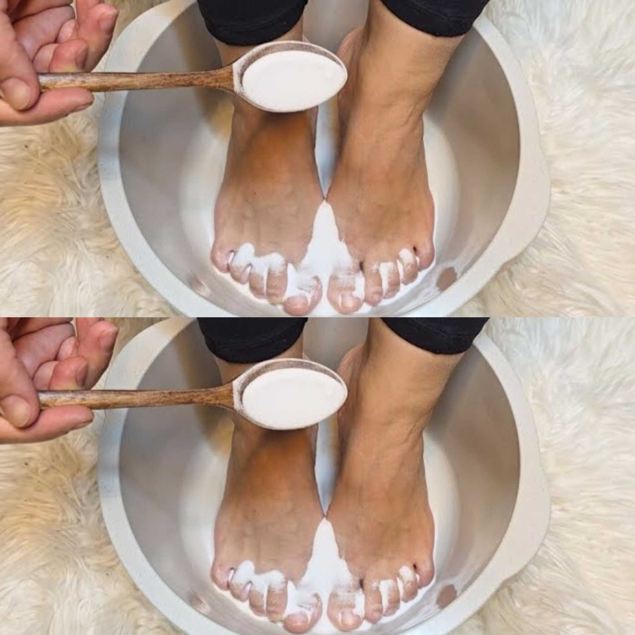 I put baking soda on my feet and look what happened !