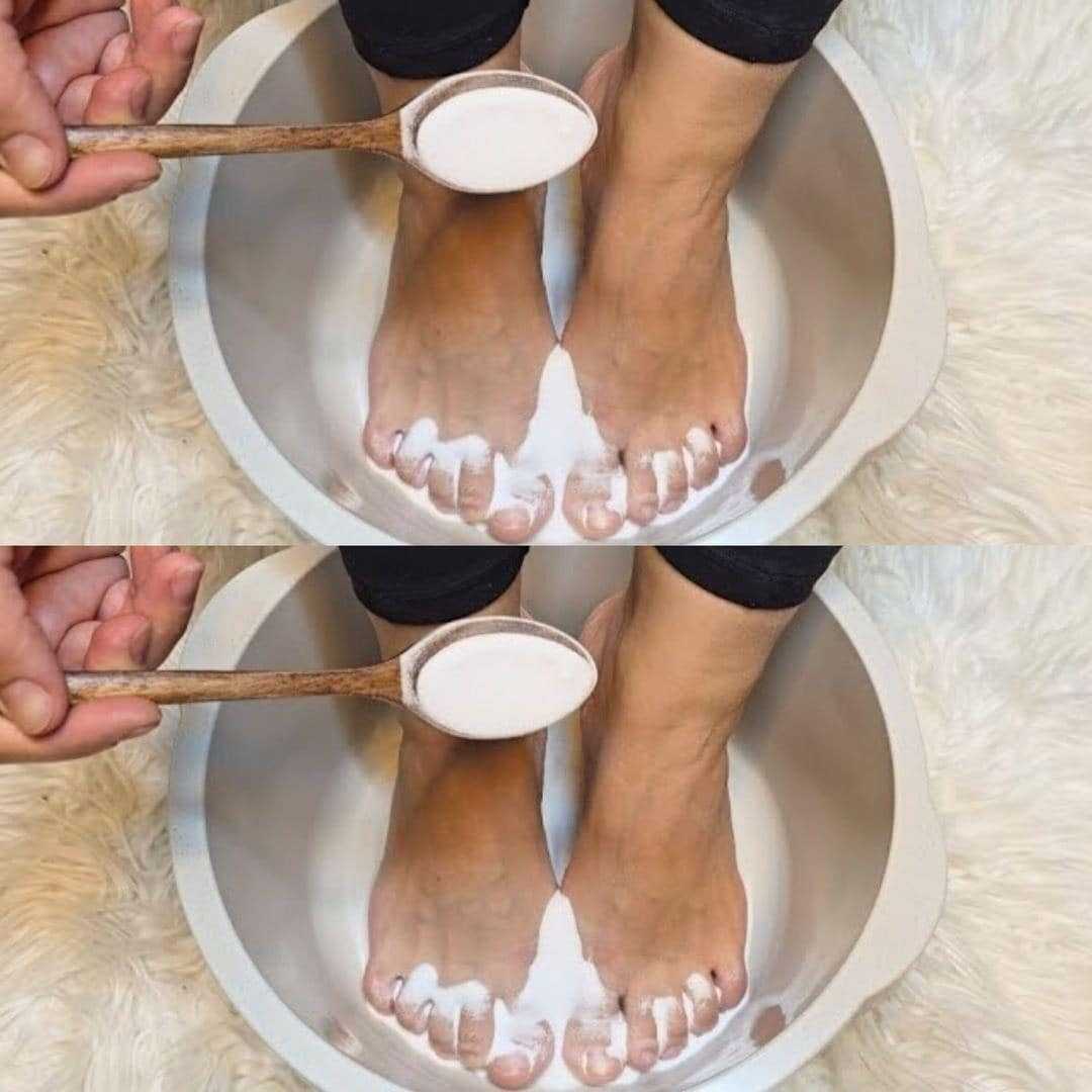 I put baking soda on my feet and look what happened !