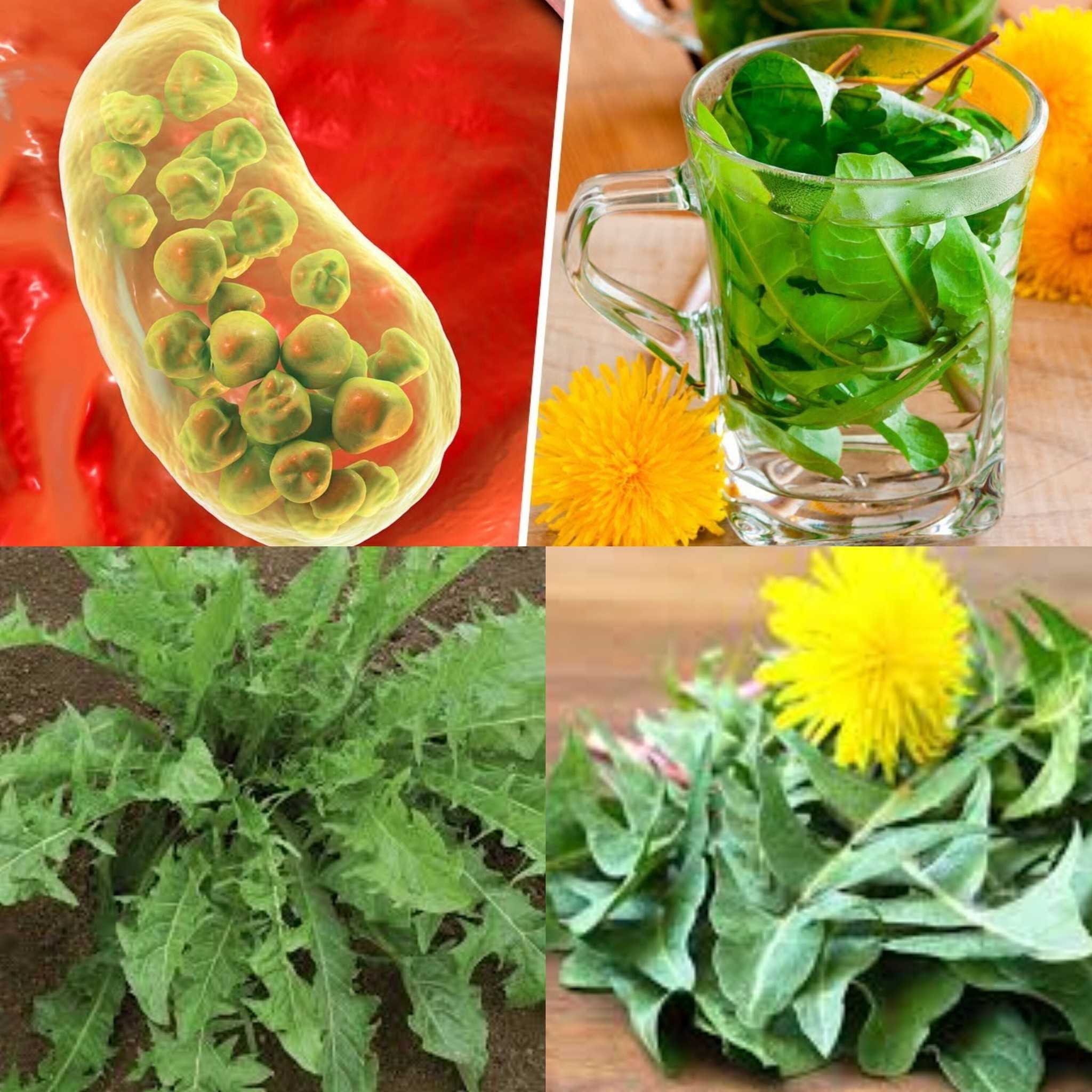 Natural Gallbladder Cleanse Using Dandelion Leaves