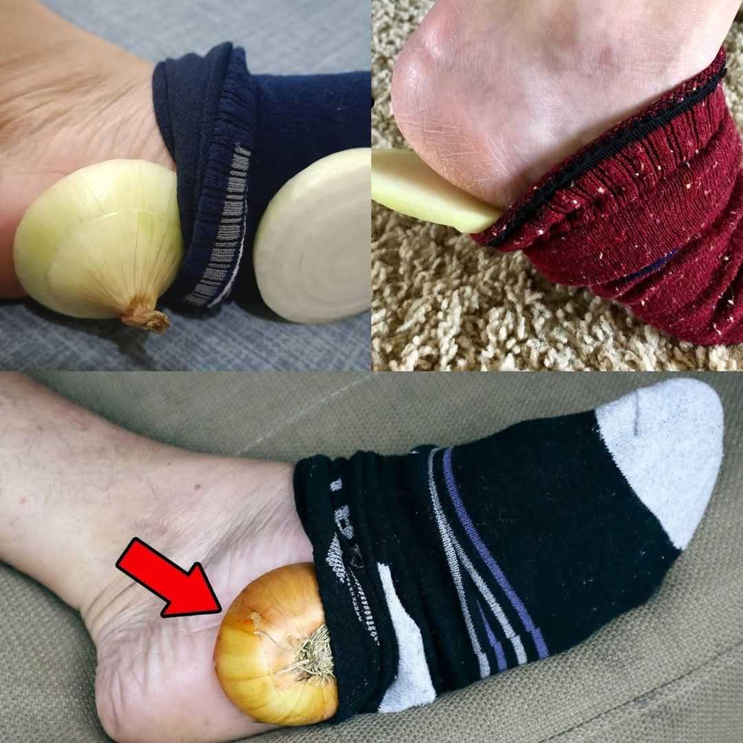 The Surprising Benefits of Putting an Onion in Your Sock