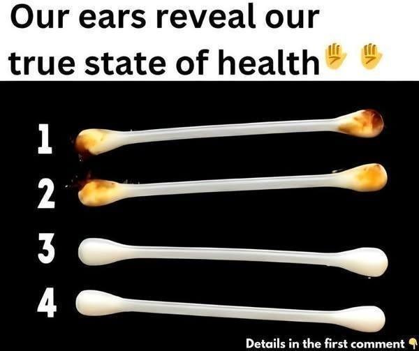What Your Earwax Says About Your Health