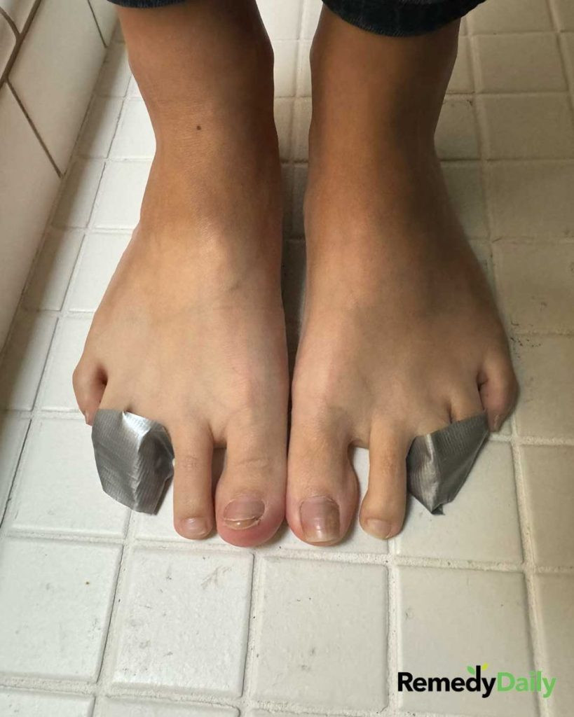 Lady tapes her 3rd and 4th toes together for this brilliant reason!