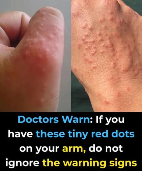 Don’t overlook these small red spots on your arm – They could be important w.arning signs