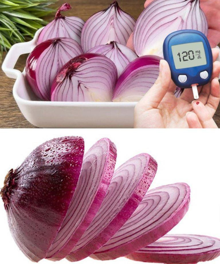 Instantly Lower Blood Sugar with This Red Onion Recipe! A Kitchen Treasure Few Know About