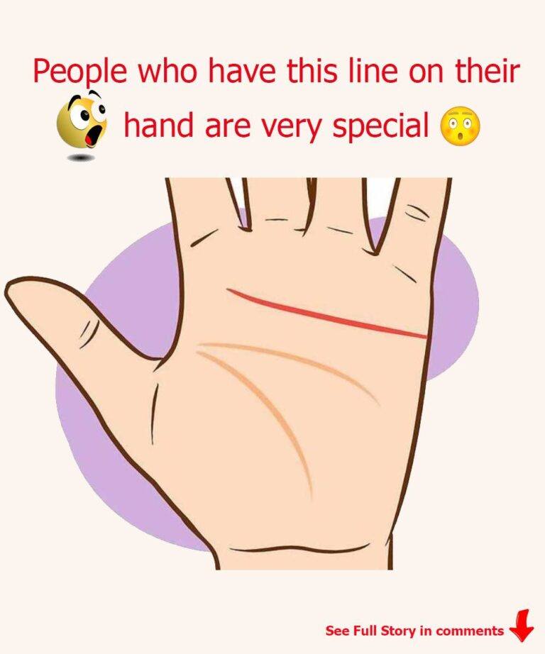 People who have this line on their hand are very special.