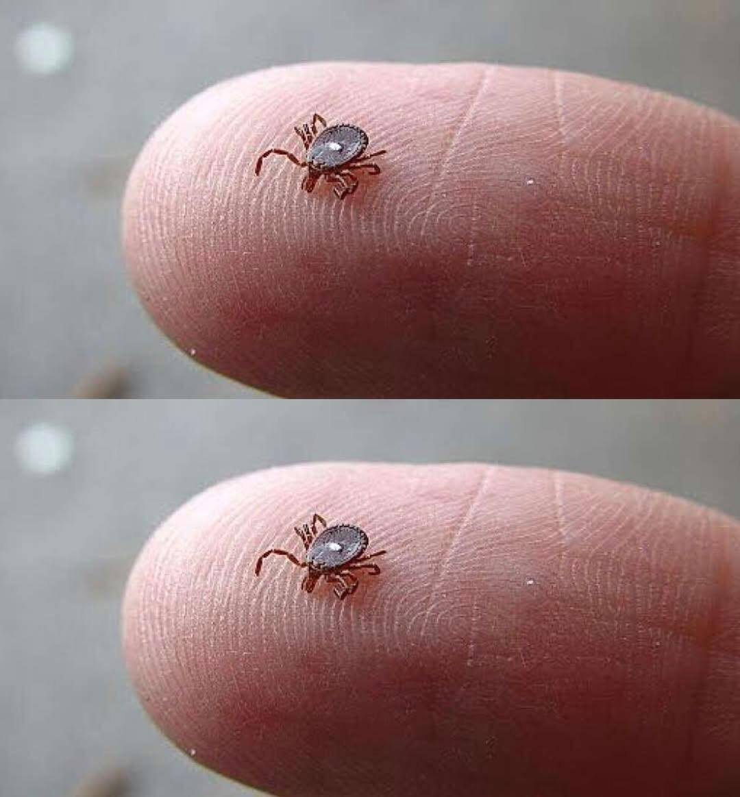 6 Lone Star Tick Diseases You Can Get From an Infected Bite