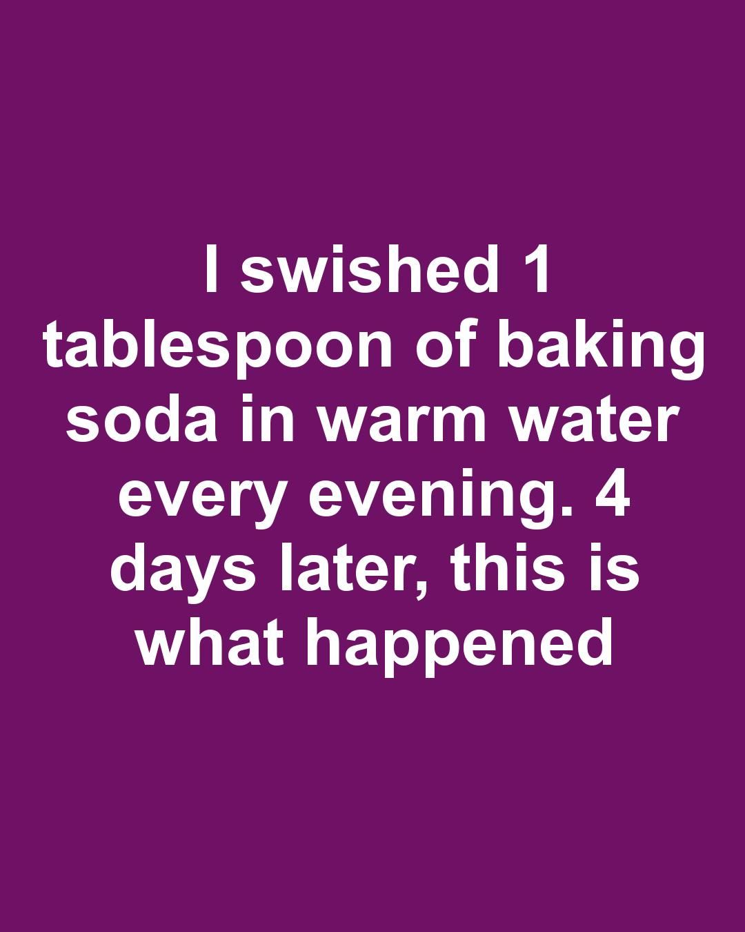 I swished 1 tablespoon of baking soda in warm water every evening. 4 days later, this is what happened