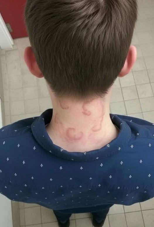 My 8 year old son been having this for 2 months straight it’s gotten worse from the first time he had this..