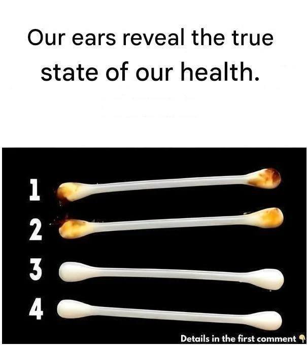The human body never ceases to amaze us with its functioning. It is in fact able to send signals to alert us of a condition or problem through the various organs and areas that compose it. Furthermore, did you know that our ears can tell us a lot about our health?