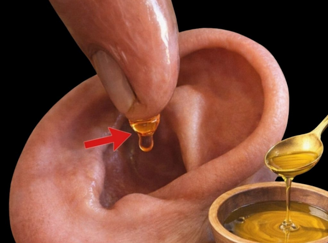 Natural Remedies for Earache and Ear Infections: Safe Ways to Find Comfort at Home